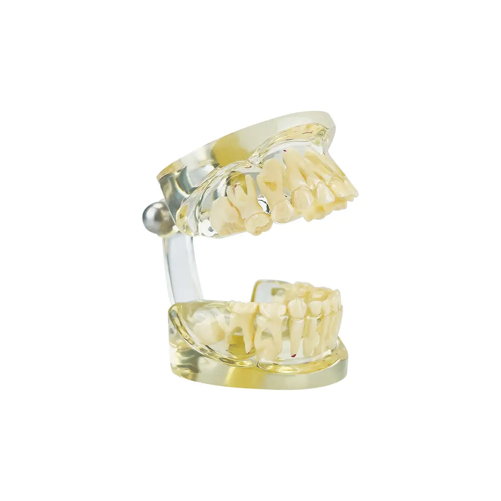 Модель Стоматологического образования Прозрачная Детская Модель Молочных Молочных Зубов Лабораторная Модель Патологической Стоматологии Инструменты Для Обучения Студентов-Стоматологов Изображение 2 